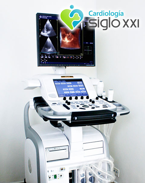 ECOCARDIOGRÁMA